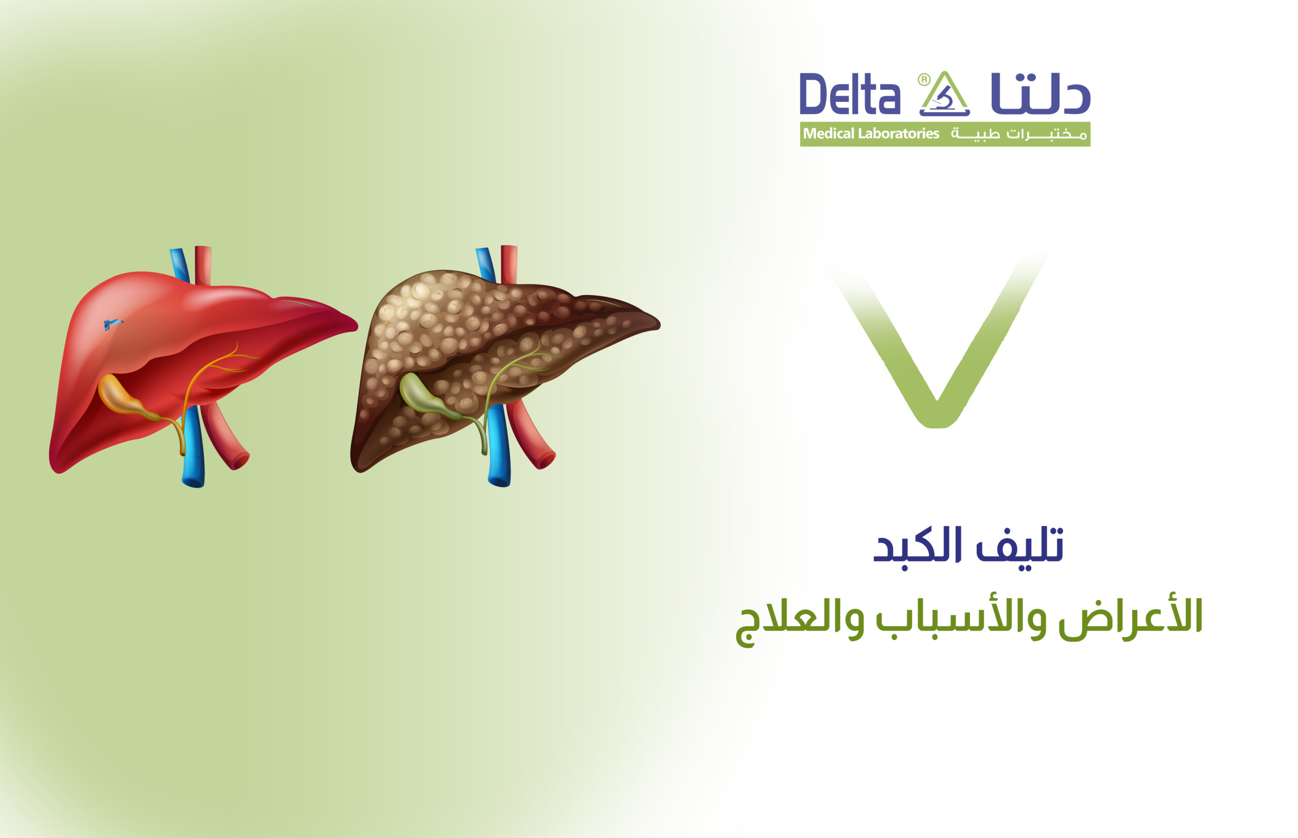 تليف الكبد أعراضه وأسبابه وتشخيصه وعلاجه