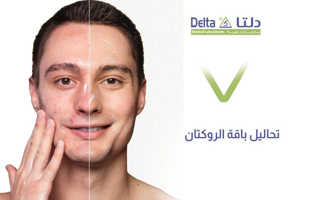 تحاليل باقة الروكتان