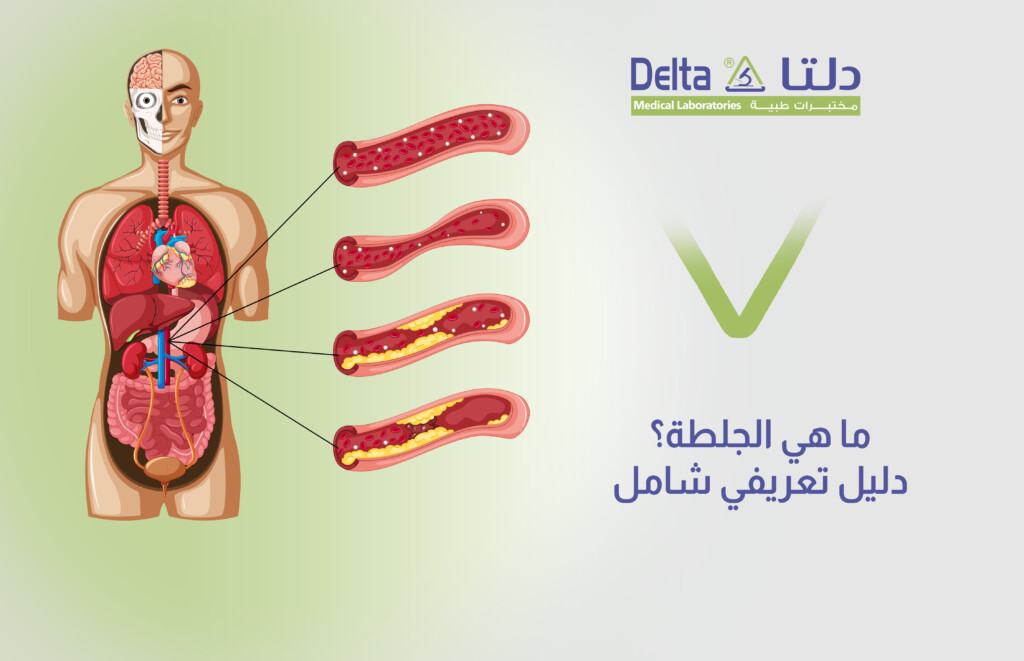 ما هي الجلطة وما هي أعراض الجلطة وأنواع الجلطة