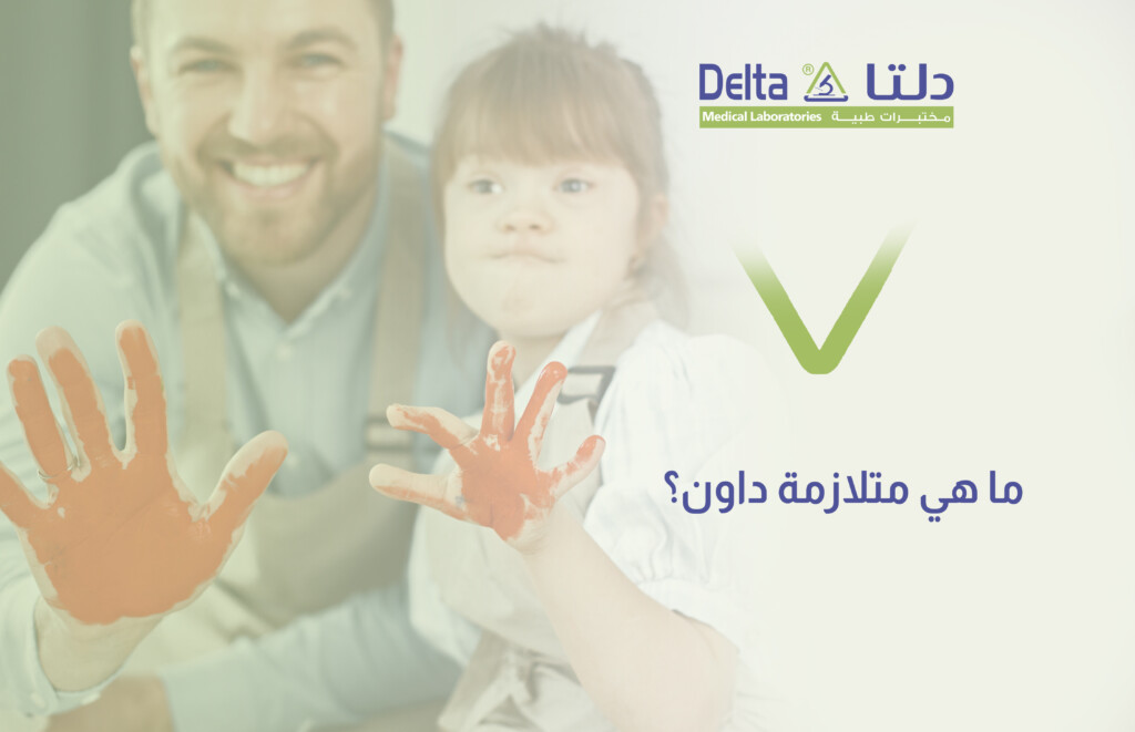 متلازمة داون