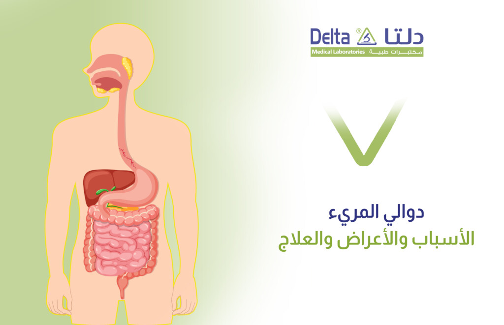 ما هي دوالي المريء ، وما هي أعراض وأسباب وعلاج المريء