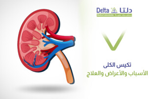 تكيس الكلى