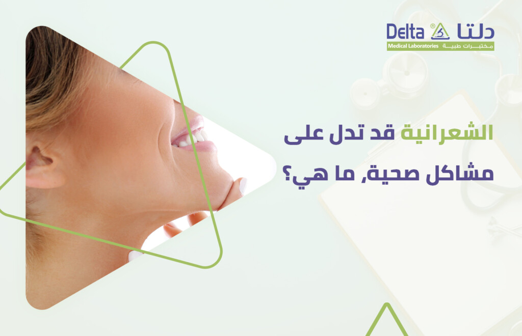 ما هي أسباب زيادة الشعر عند النساء أو الشعرانية وما هي المشاكل الصحية المرتبطة بها