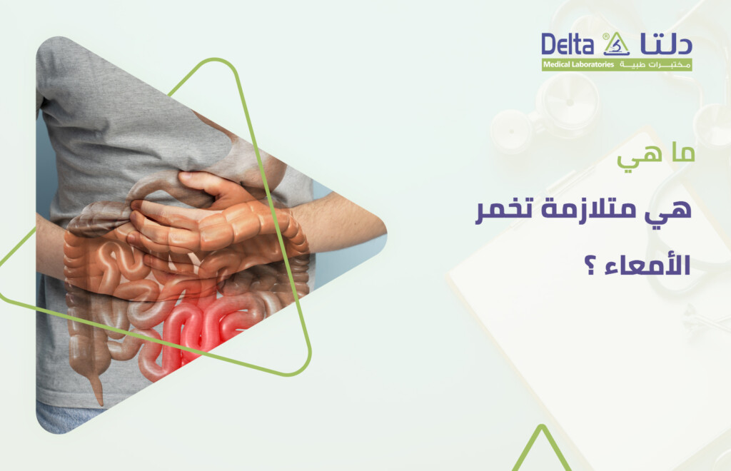 متلازمة تخمر الأمعاء وما هو علاج تخمر الأمعاء