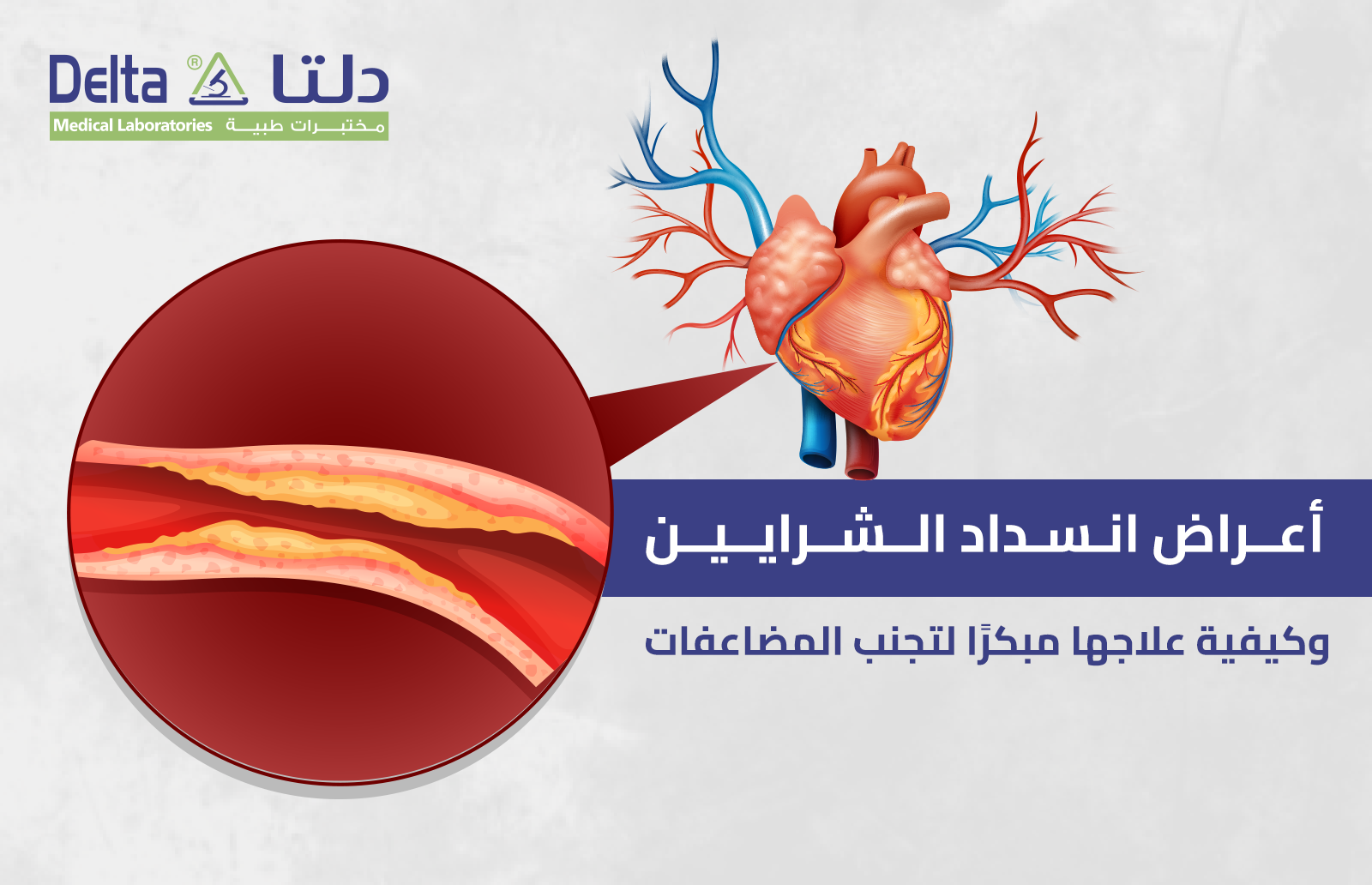 أعراض انسداد الشرايين وكيفية علاجها مبكرًا لتجنب المضاعفات