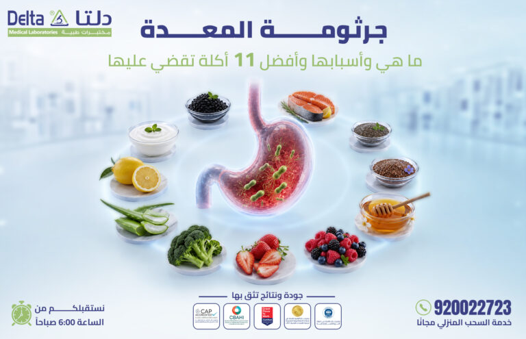 جرثومة المعدة