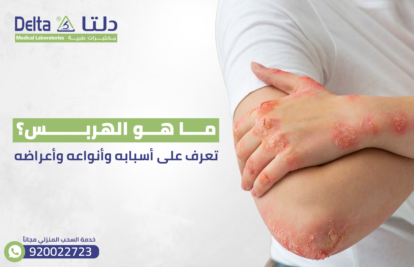 ما هو الهربس؟ تعرف على أسبابه وأنواعه وأعراضه