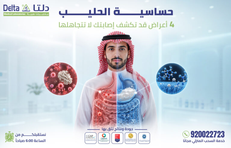 حساسية الحليب