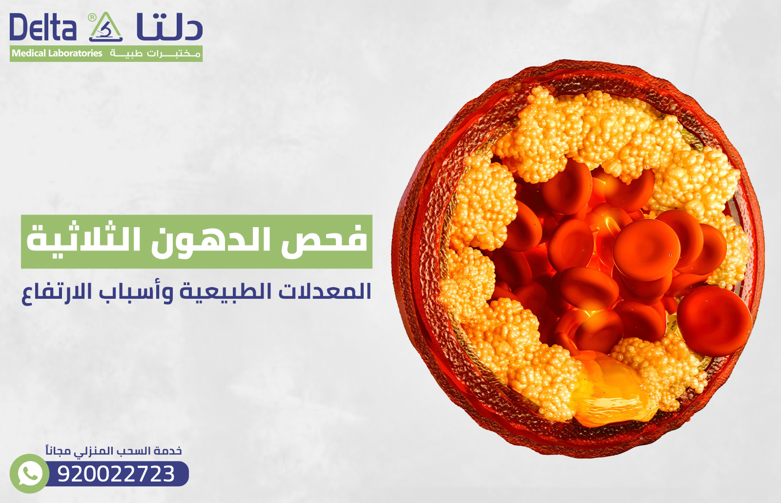 فحص الدهون الثلاثية: المعادلات الطبيعية وأسباب الارتفاع