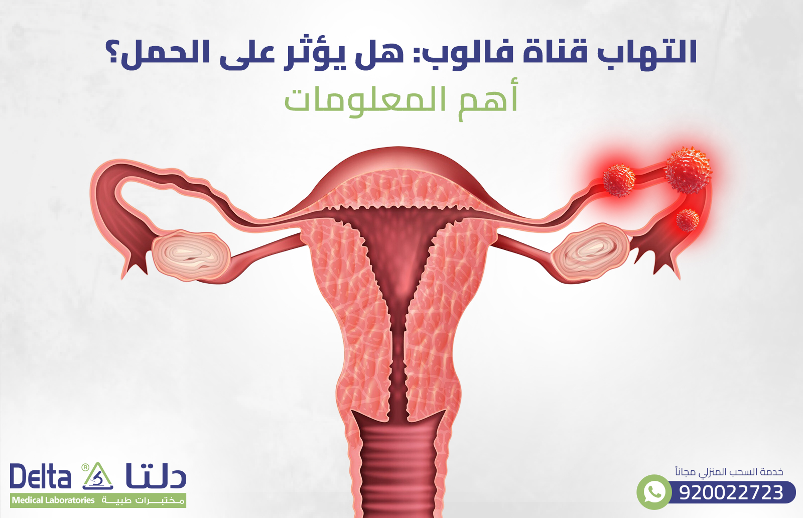 التهاب قناة فالوب: هل يؤثر على الحمل؟| أهم المعلومات