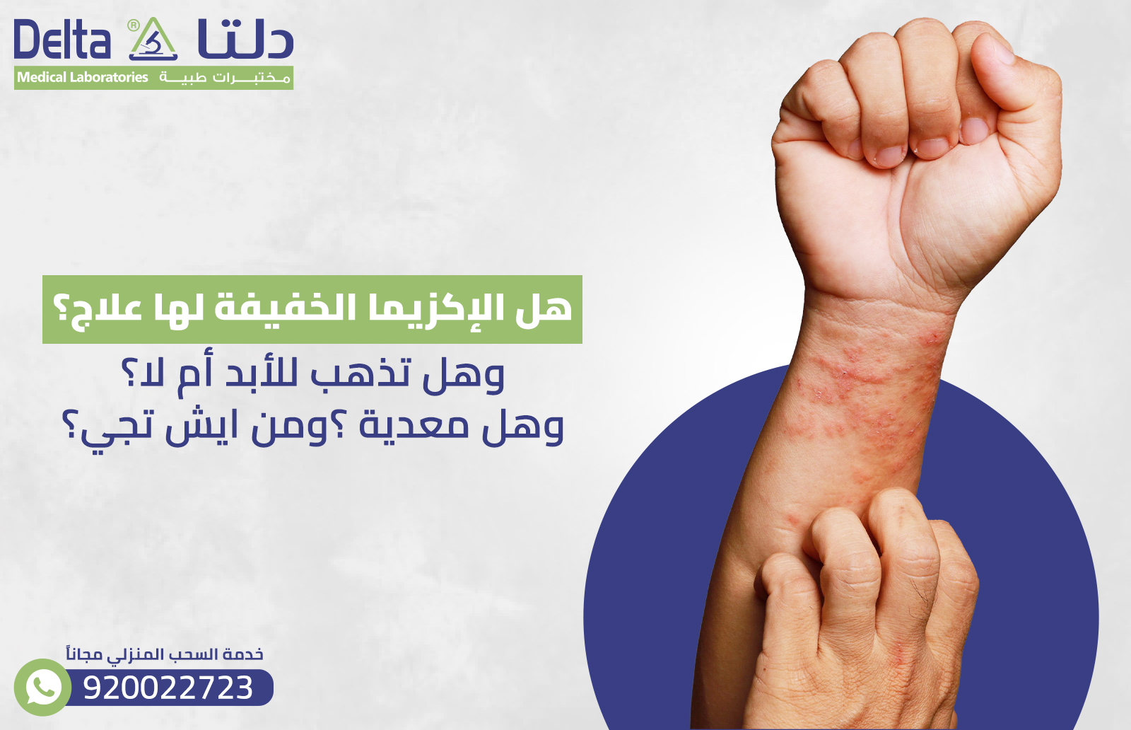 هل الإكزيما الخفيفة لها علاج؟ وهل تذهب للأبد أم لا وهل معدية