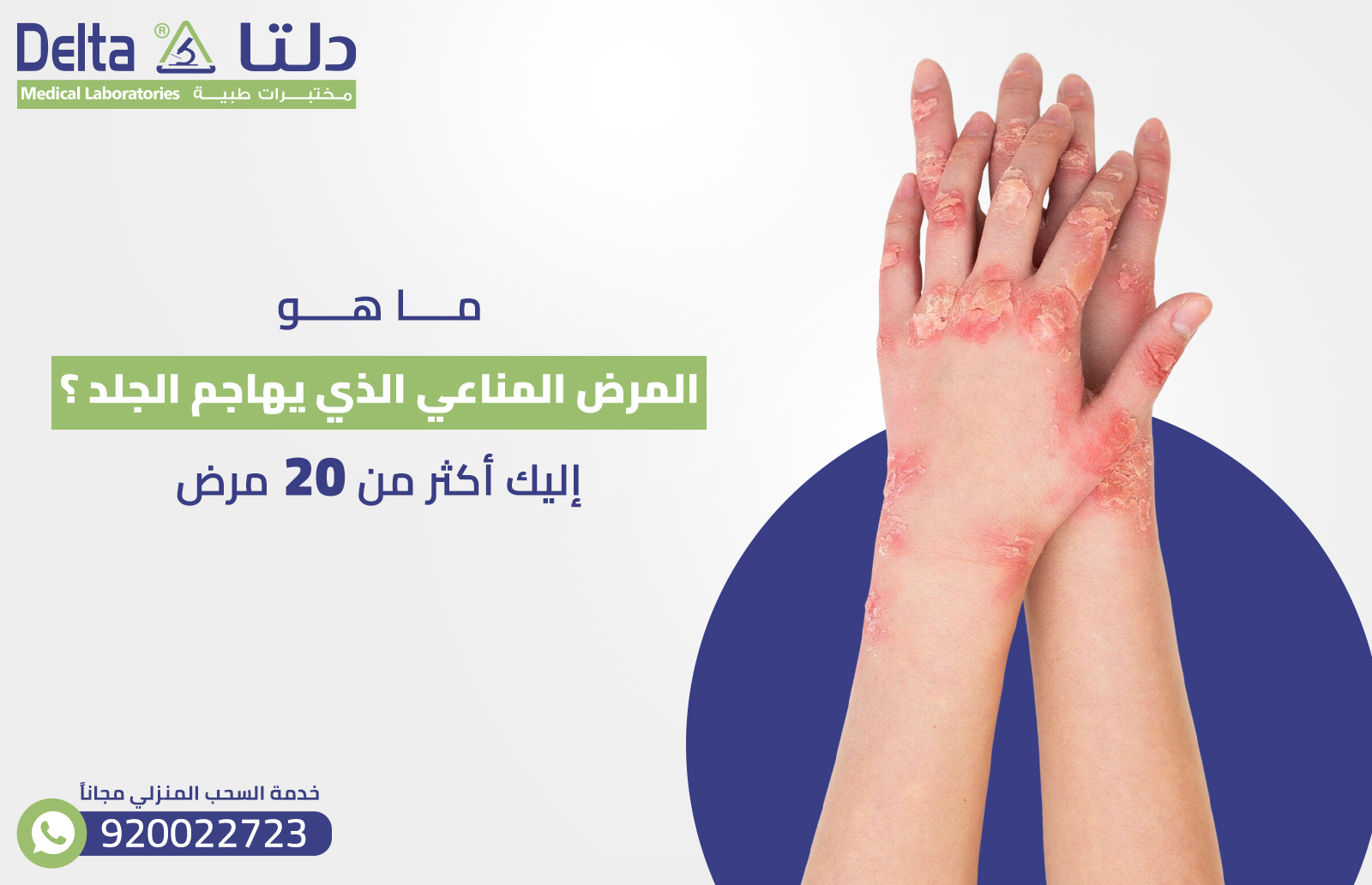 ما هو المرض المناعي الذي يهاجم الجلد ؟ إليك أكثر من 20 مرضش