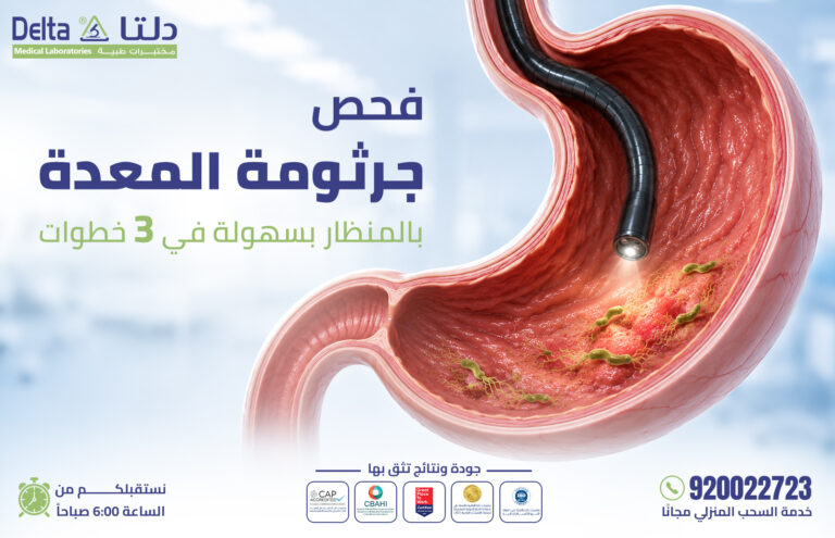 فحص جرثومة المعدة بالمنظار