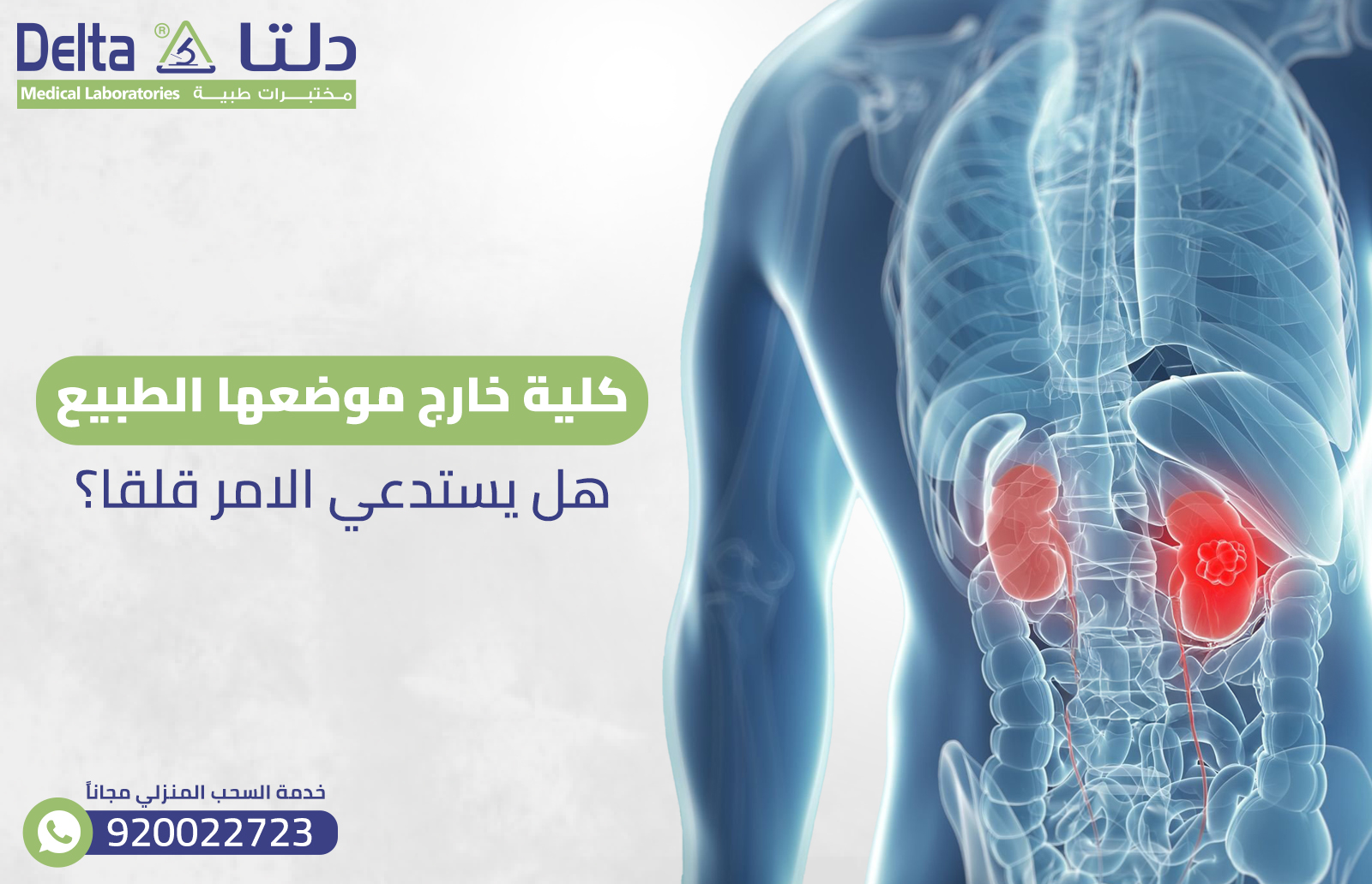كلية خارج موضعها الطبيعي هل يستدعي الامر قلقا؟