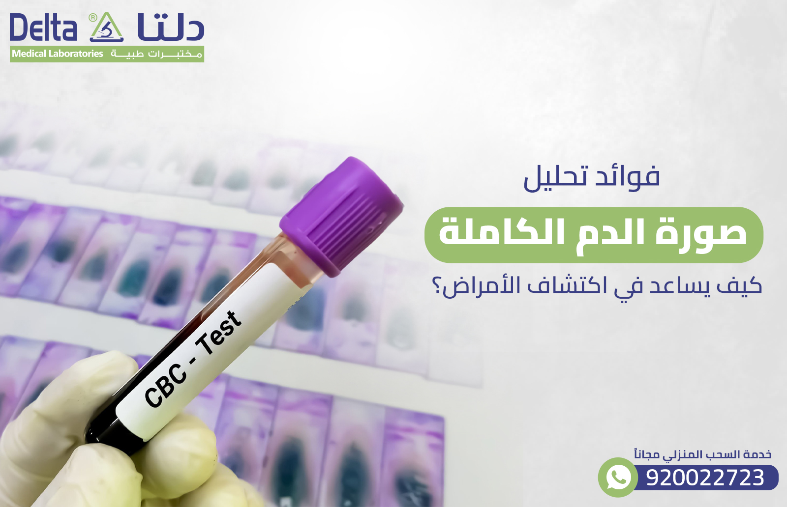 فوائد تحليل صورة الدم الكاملة: كيف يساعد في اكتشاف الأمراض؟