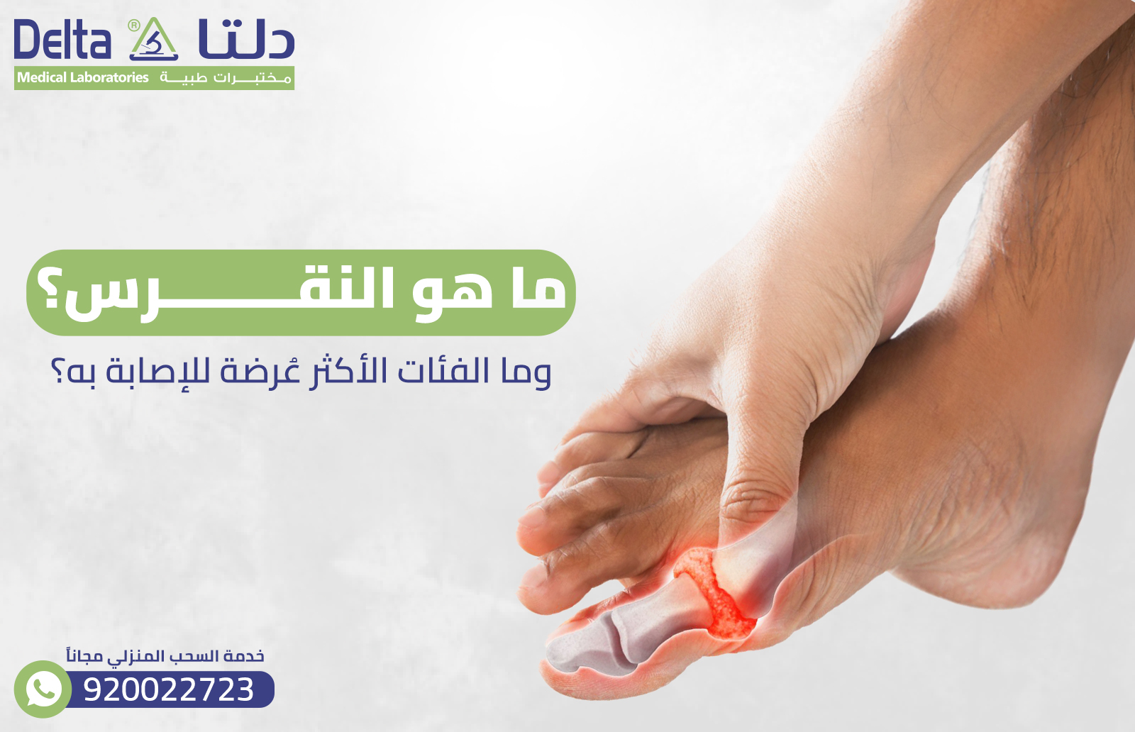 ما هو النقرس؟ وما الفئات الأكثر عُرضة للإصابة به؟