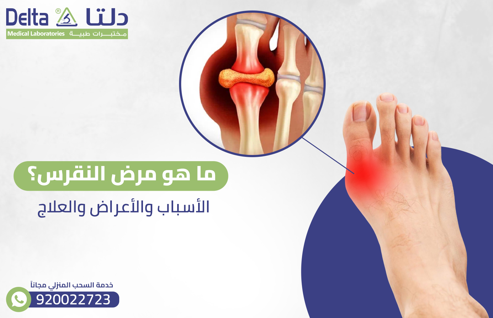 ما هو مرض النقرس؟ الأسباب والأعراض والعلاج