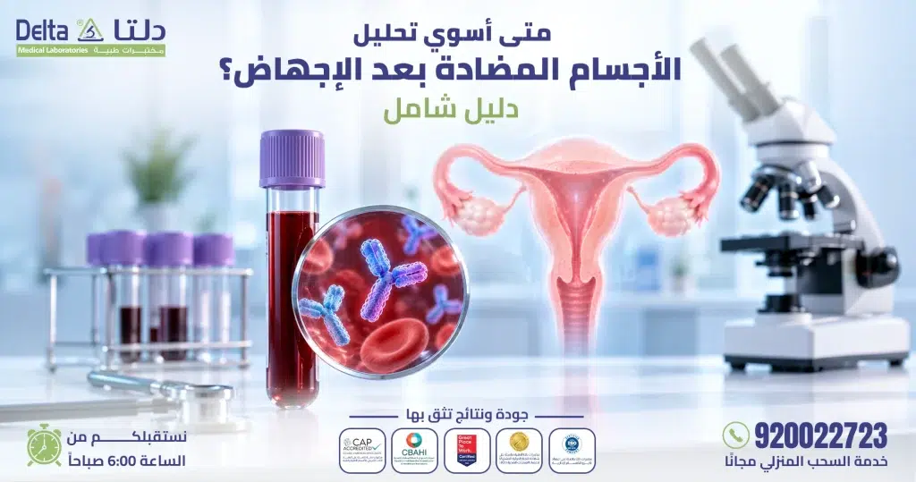 متى اسوي تحليل الأجسام المضادة بعد الإجهاض؟ دليل شامل