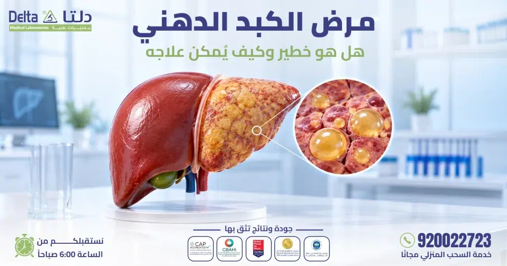 مرض الكبد الدهني: هل هو خطير وكيف يمكن علاجه؟