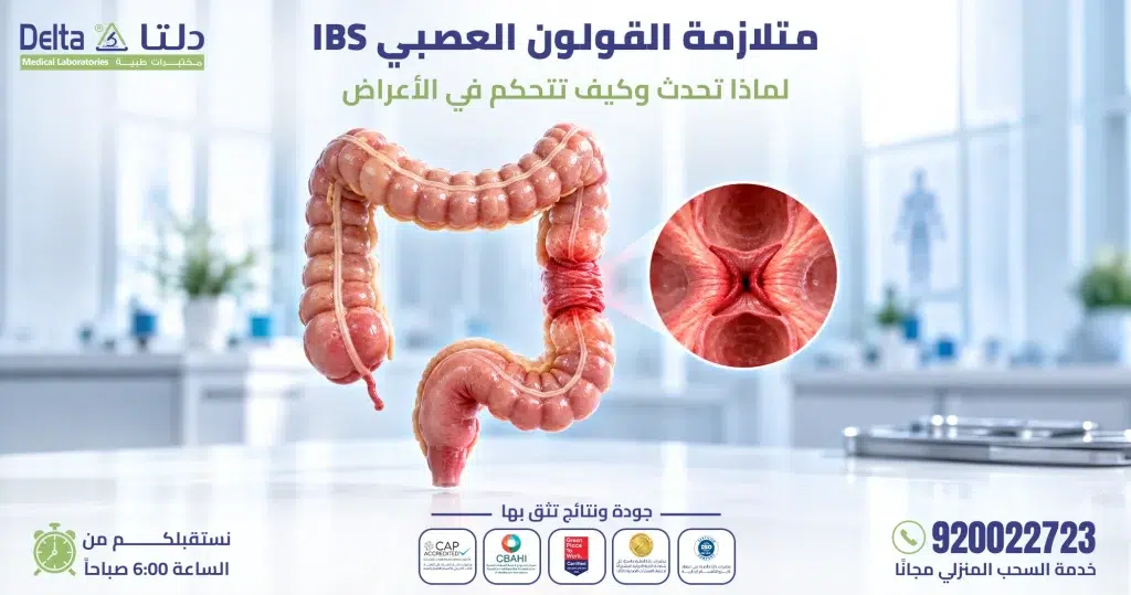 متلازمة القولون العصبي IBS: لماذا تحدث وكيف تتحكم في أعراضها؟