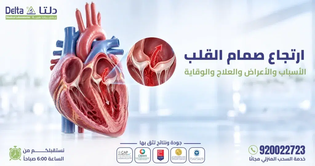صمام القلب ارتجاع: الأسباب، الأعراض، والحلول ، والوقاية