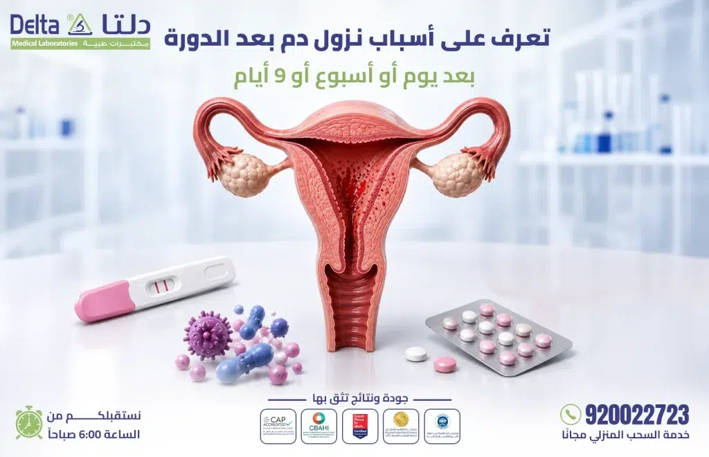 نزول دم بعد الدورة - الأسباب ودلالات الألوان