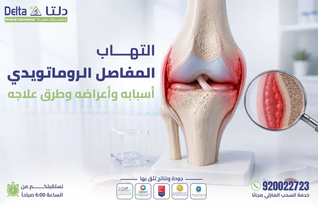 التهاب المفاصل الروماتويدي - الأعراض والأسباب وطرق العلاج