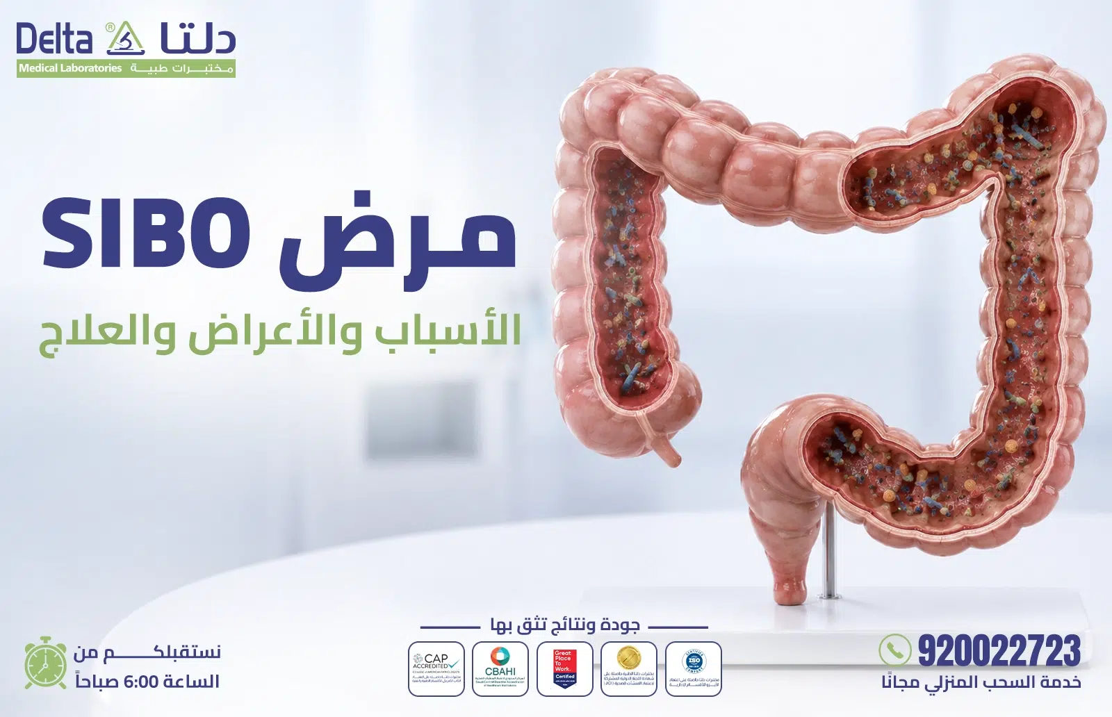فحص SIBO لتشخيص فرط نمو البكتيريا في الأمعاء الدقيقة في مختبرات دلتا الطبية