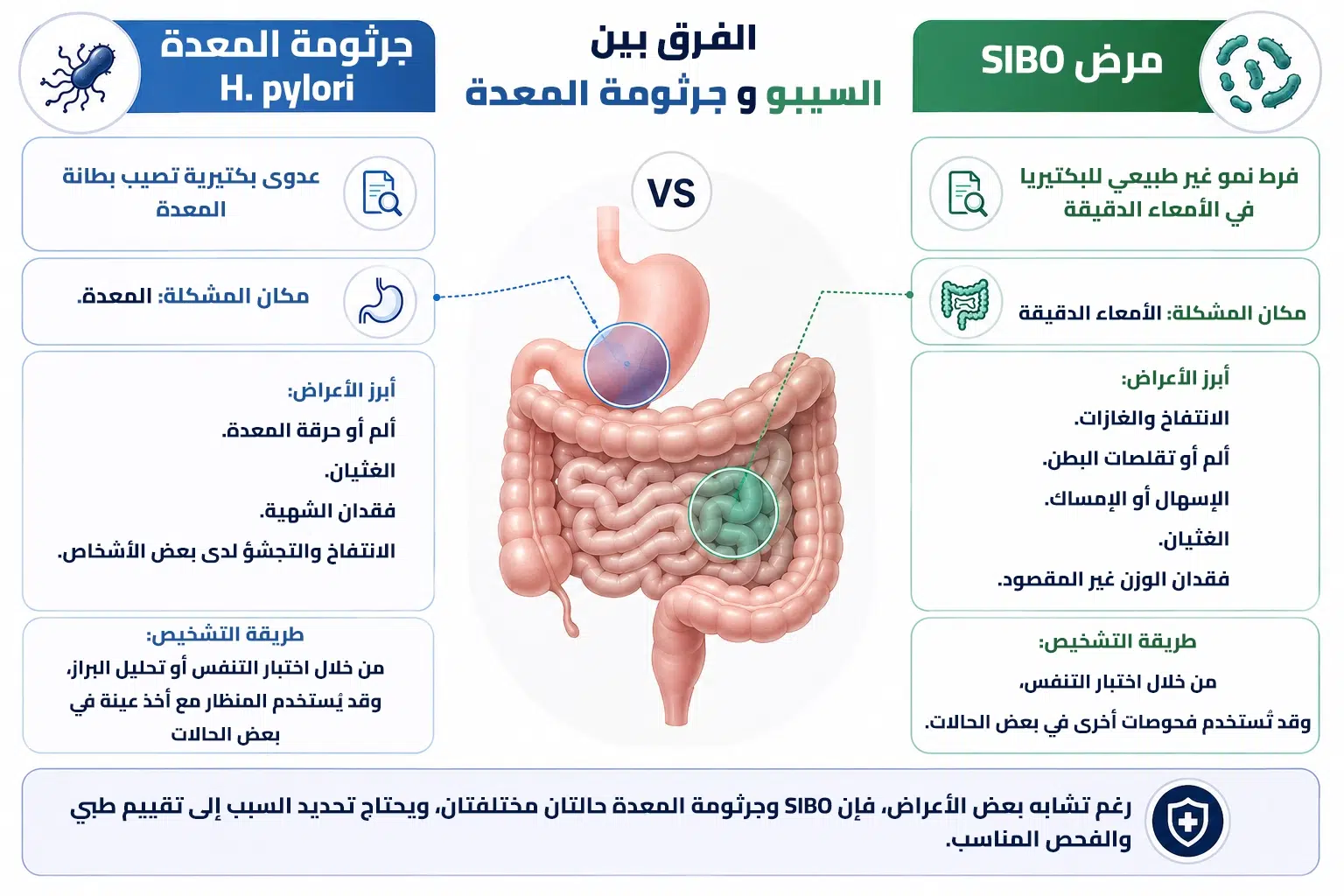 الفرق بين مرض SIBO وجرثومة المعدة من حيث مكان الإصابة والأعراض والتشخيص