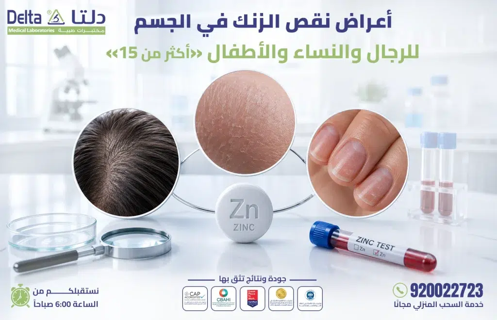 أعراض نقص الزنك في الجسم عند الرجال والنساء والأطفال - مختبرات دلتا الطبية