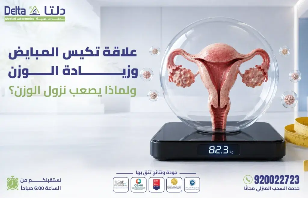 تكيس المبايض وزيادة الوزن