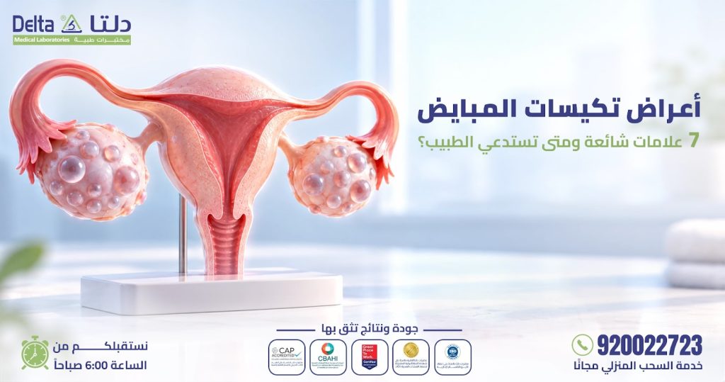 أعراض تكيسات المبايض وعلاماتها الشائعة