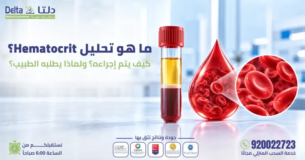 تحليل الهيماتوكريت Hematocrit (HCT) لقياس نسبة خلايا الدم الحمراء