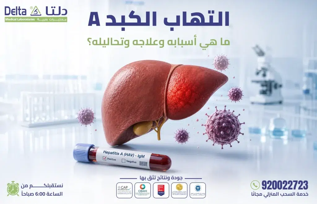 التهاب الكبد A أسبابه وأعراضه وطرق علاجه