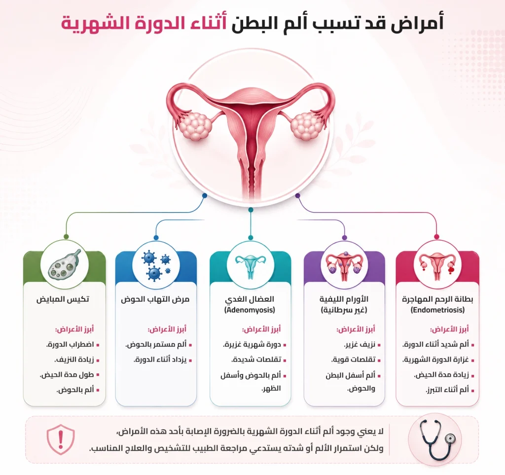 رسم توضيحي يشرح اضطرابات الدورة الشهرية وألم البطن أثناء الحيض