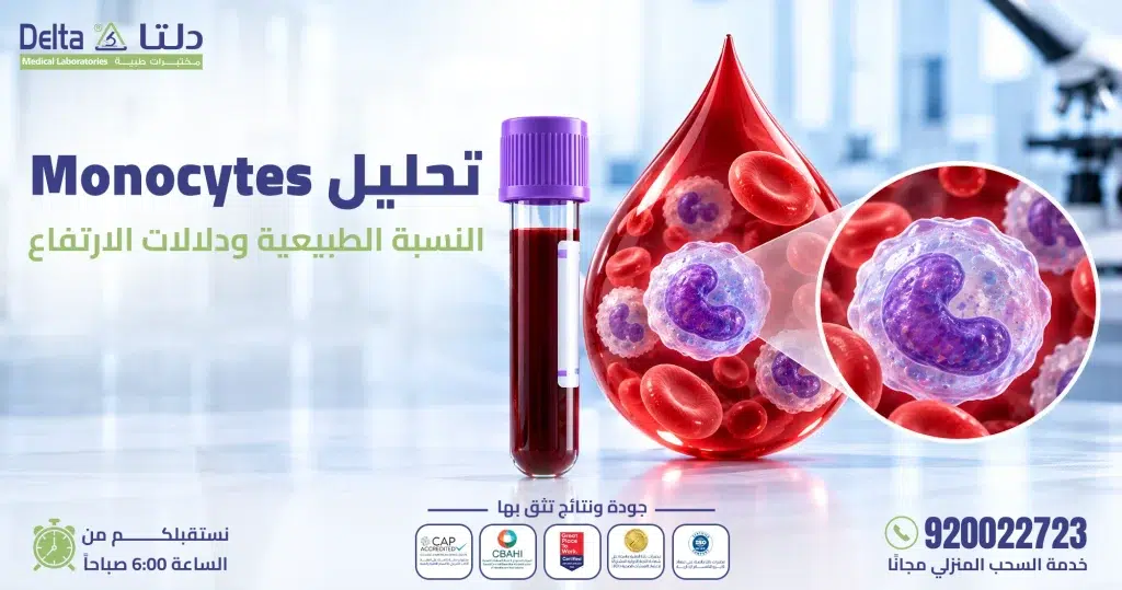 تحليل Monocytes الخلايا الوحيدة ضمن صورة الدم الكاملة CBC