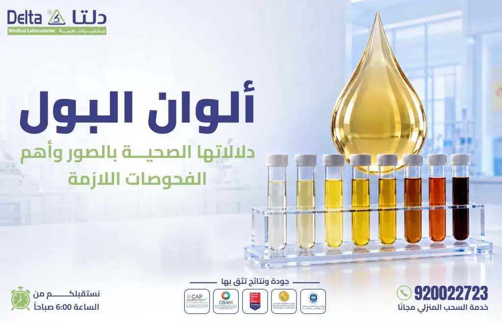 ألوان البول ودلالتها الصحية