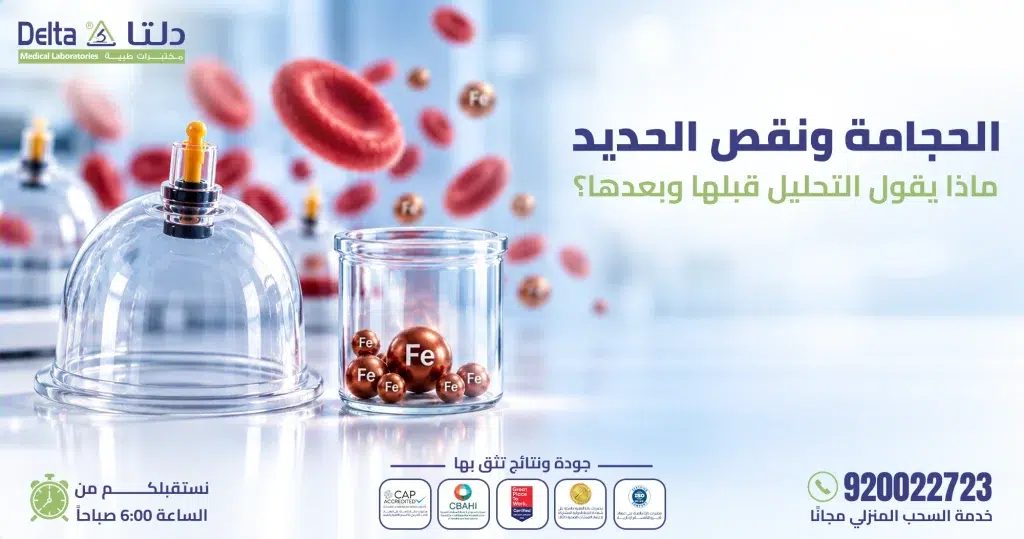 الحجامة ونقص الحديد