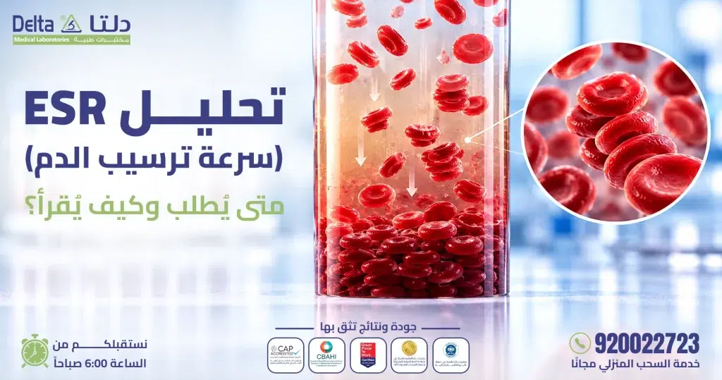 تحليل ESR سرعة ترسيب الدم