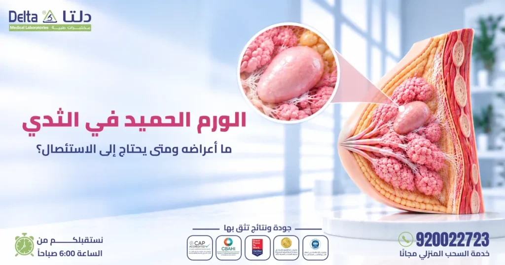 طبيبة تفحص الثدي بالسونار لتشخيص الورم الحميد في الثدي