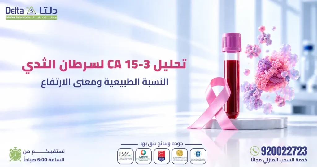 تحليل CA 15-3 لسرطان الثدي في مختبرات دلتا الطبية