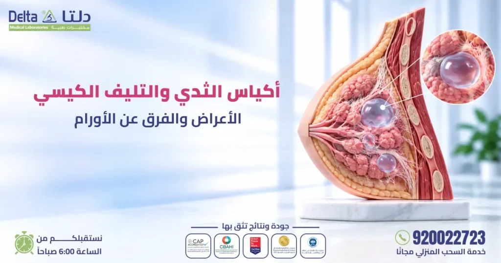 أكياس الثدي والتليف الكيسي والفرق بينها وبين الأورام