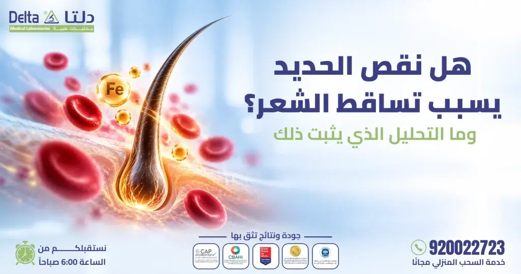 هل نقص الحديد يسبب تساقط الشعر