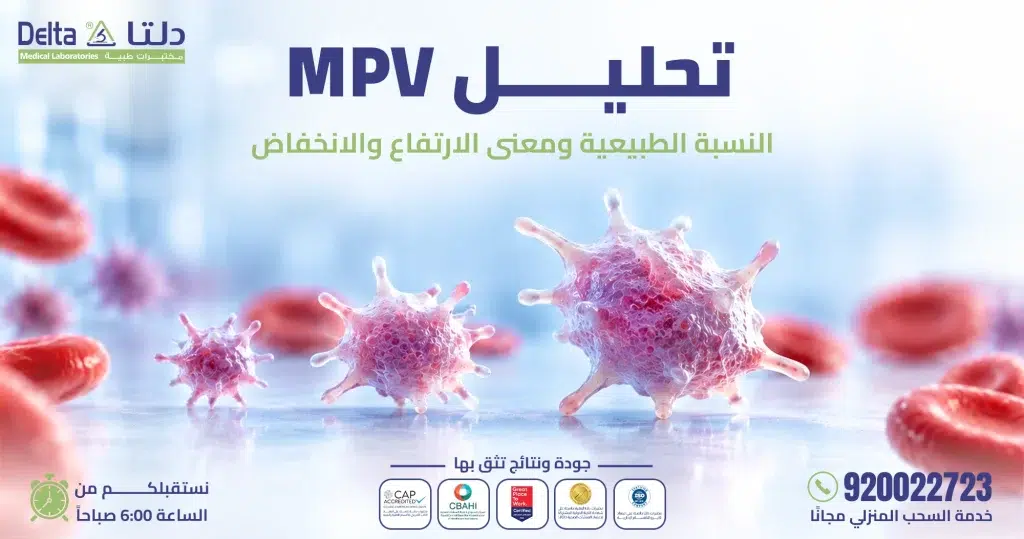 تحليل MPV