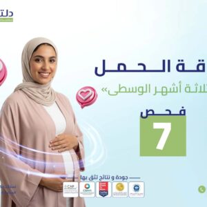 باقة الحمل (الثلاثة أشهر الوسطي)