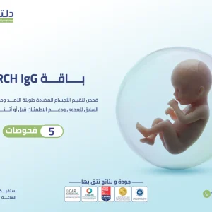 باقة TORCH IgG
