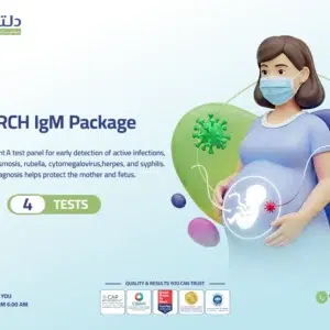 TORCH IgM
