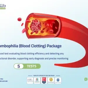Blood Clotting