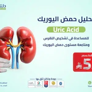 تحليل حمض اليوريك