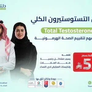 فحص التستوستيرون الكلي